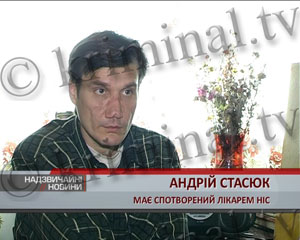 Пластический хирург с дипломом стоматолога провел операцию, и изуродовал мужчине лицо