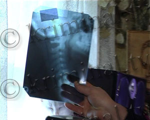 За игру в снежки фермер и милиционер покалечили школьника, и держат в страхе полсела